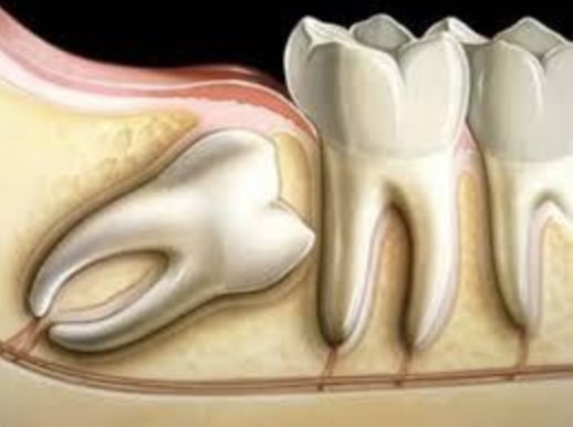 Cirurgia Oral