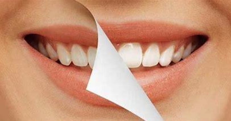 Estética Dentária