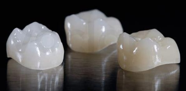 Estética Dentária