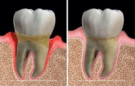 Periodontologia